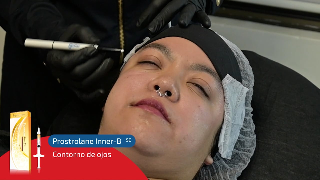 prostolane inner B
