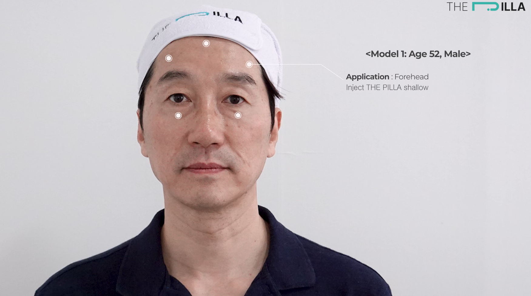 forehead - the pilla