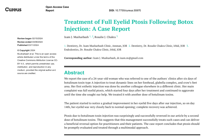 Treatment of Full Eyelid Ptosis